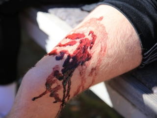 Elsősegély erőpróba (2024) - fotó: 