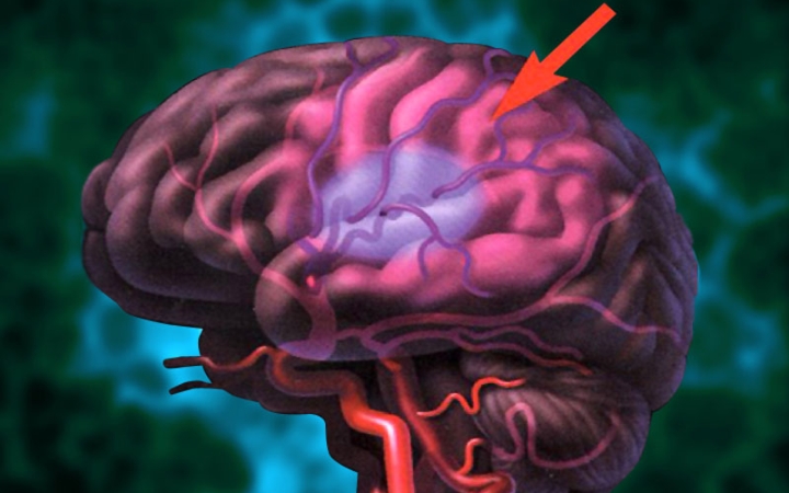 Magyar agykutatók újabb óriási felfedezése