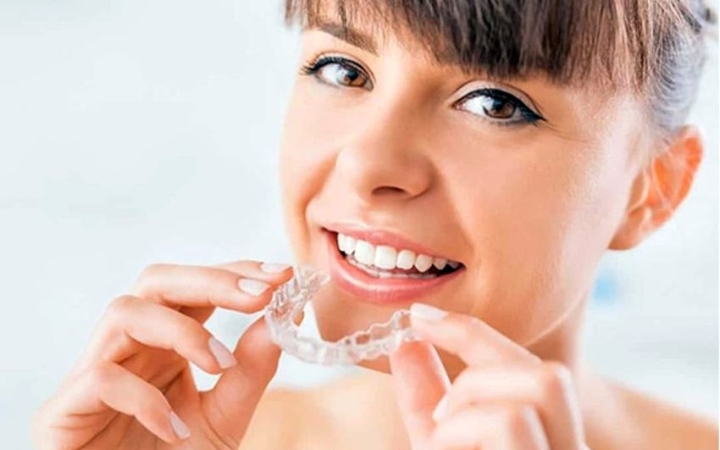 Felnőttkori fogszabályozás? Lehetséges!