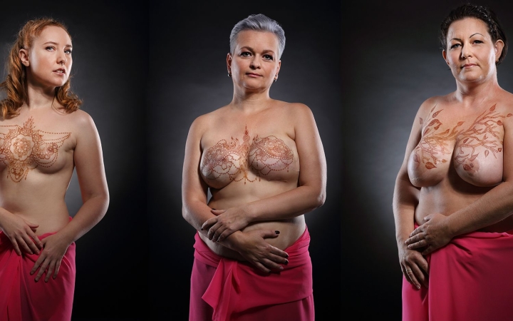 A mellrák ellen – Csikós Árpád tárlata a Bartók Kamaraszínház Aula Galériájában