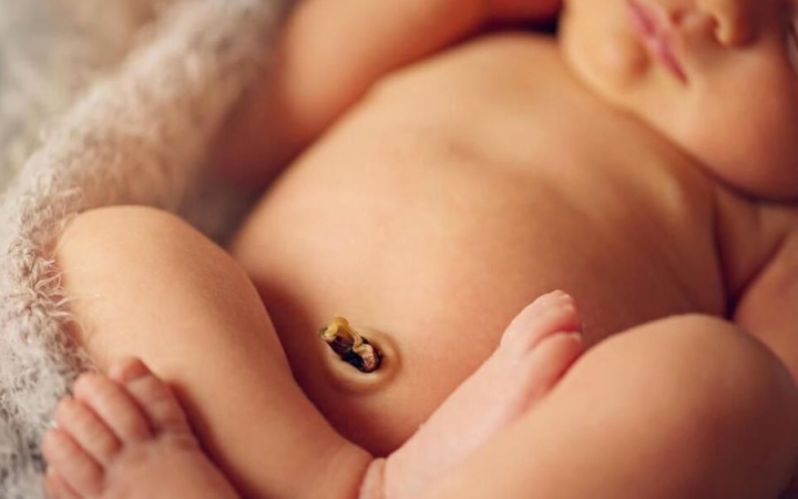 Újszülöttek köldökcsonkjának ápolása: praktikus tanácsok kezdő szülőknek