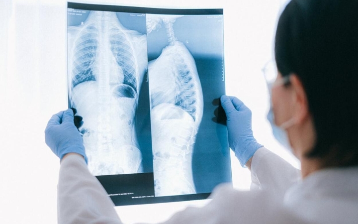 Érdekességek a tüdőről