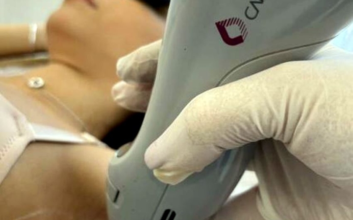 Lézeres szőrtelenítés kényelmesen