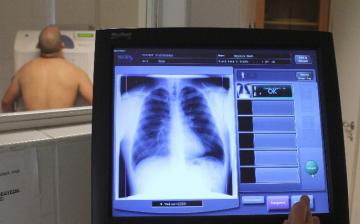 Tüdőszűrés - Előre be kell majd jelentkezni a vizsgálatra